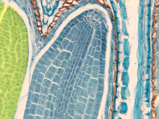 Epidermis